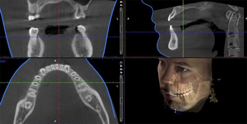 3D- Visualisierung